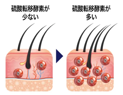 ミノキシジルの発毛効果は個人によって異なる
                                            