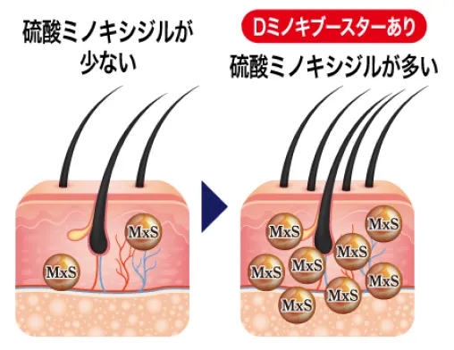 ミノキシジルの効果をサポートDミノキブースター