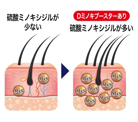 ミノキシジルの効果をサポートDミノキブースター